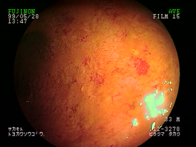 scoop picture
